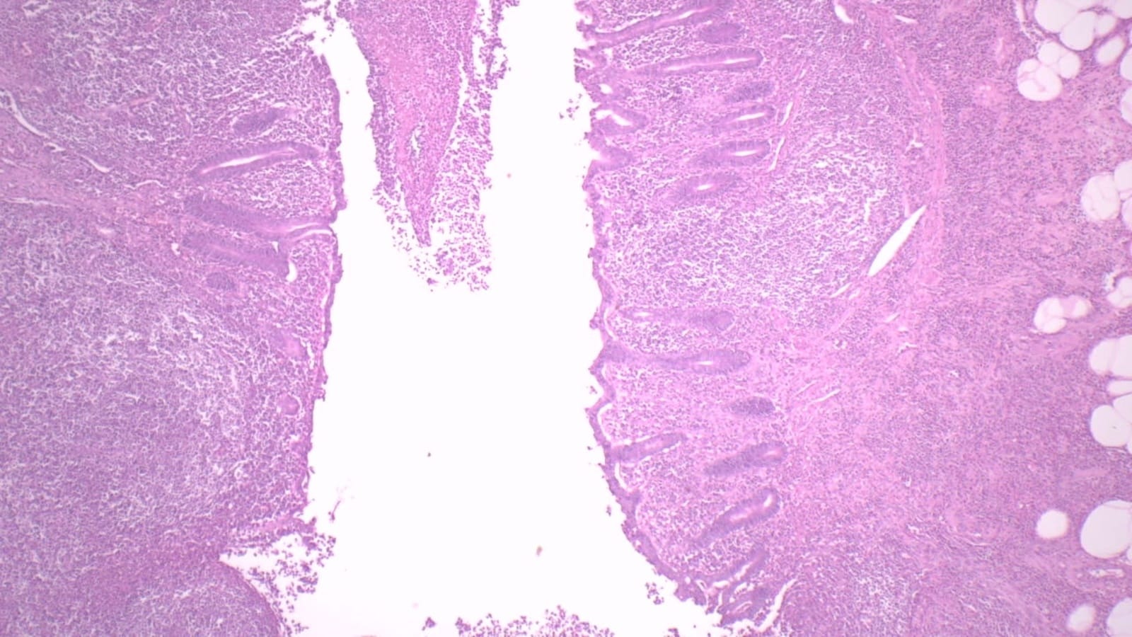 Human Appendix Slide | VWR, part of Avantor