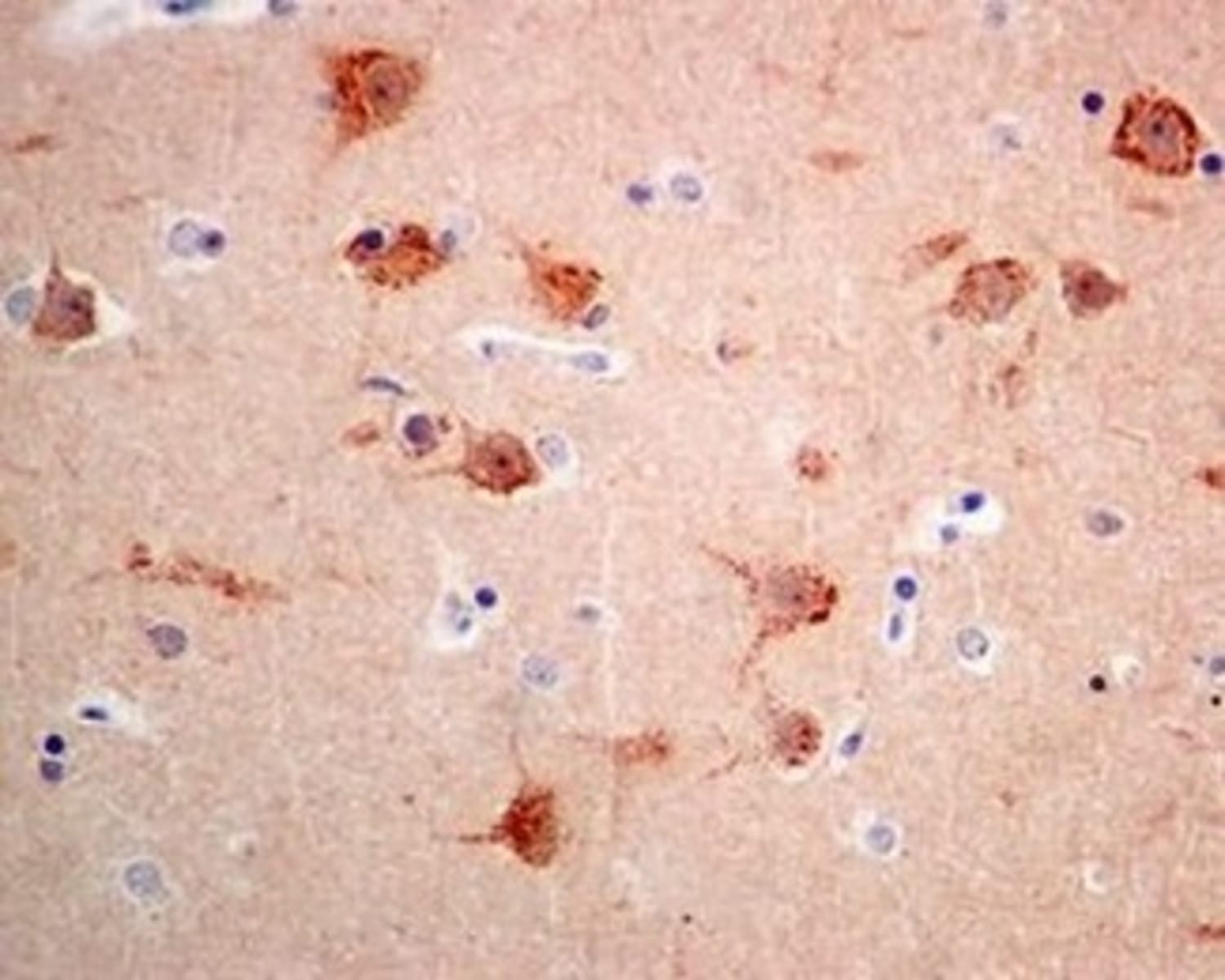 Anti-Syntenin Rabbit Monoclonal Antibody [clone: EPR8102] | VWR, part ...