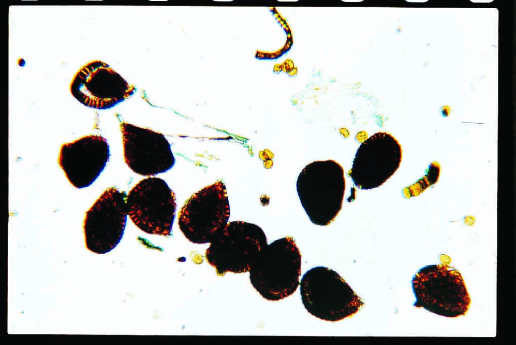 Ward's® Fern Life Cycle Slides