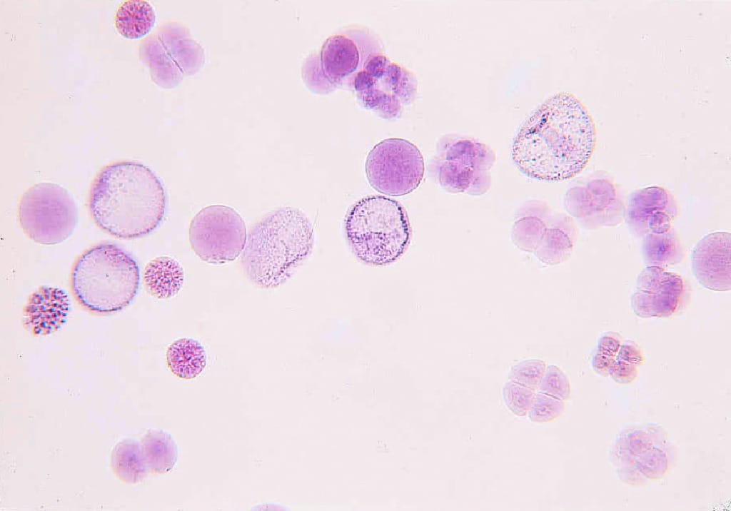 Sea Urchin Embryology, Composite Slide