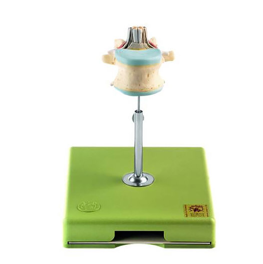 Somso® Lumbar Vertebra (L II) with Lumbar Region of Spinal Cord