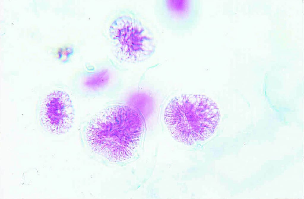 Peridinium Slide