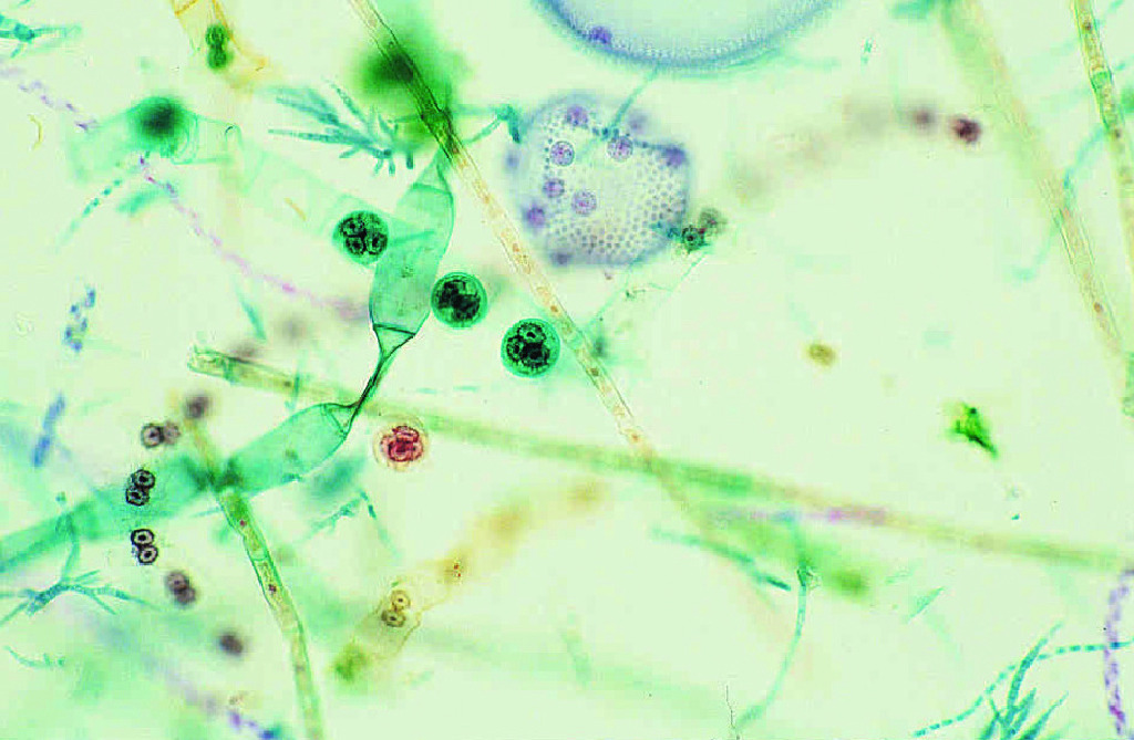Mixed Green Algae Slide