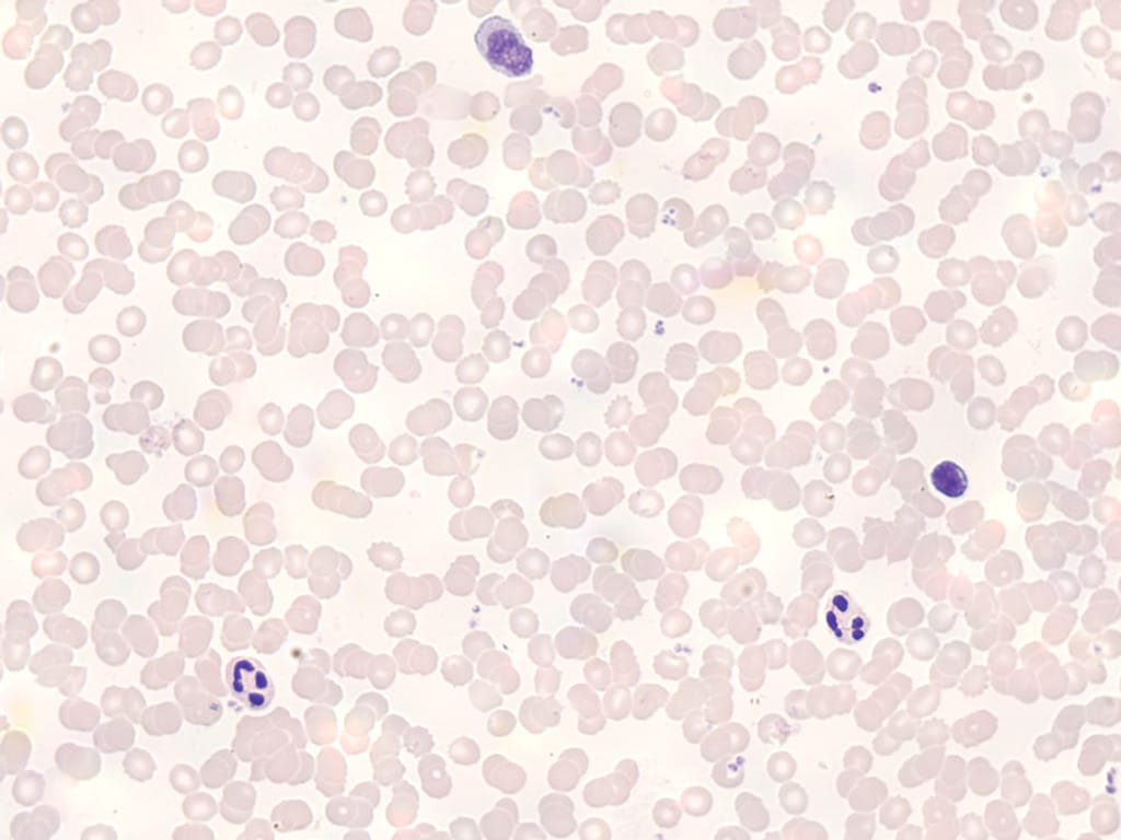Peripheral Blood, Human Female Slide