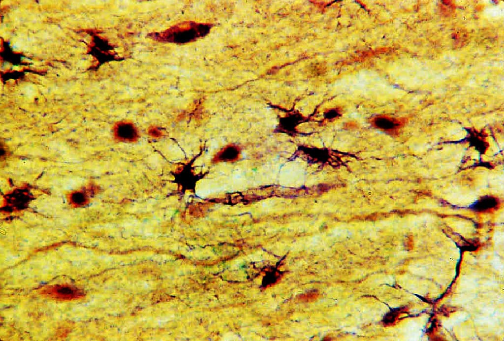 Neuroglia, Fibrous Astrocytes Slide