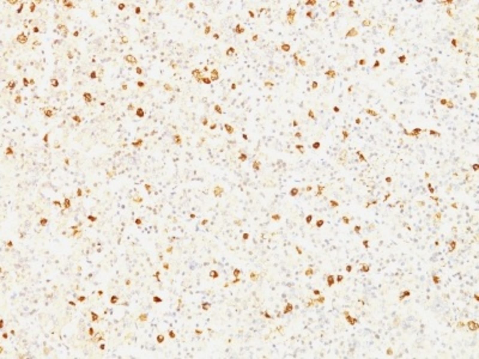 Anti-Luteinizing Hormone beta Mouse Monoclonal Antibody [clone: LHb ...