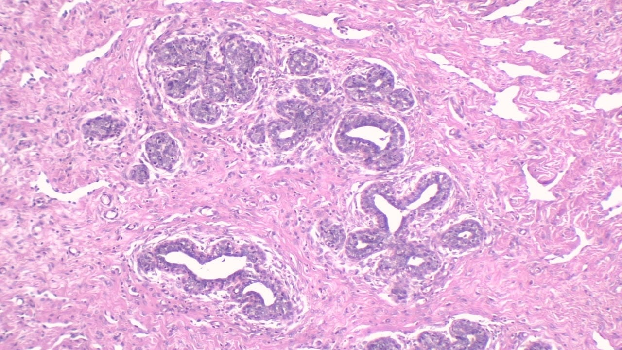 Mammary Gland, Inactive Slide