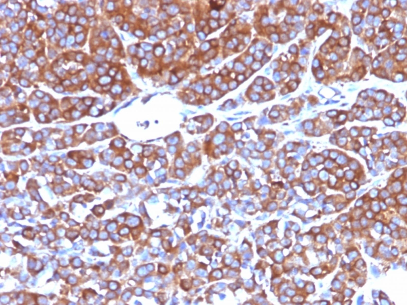 Anti-Moesin Mouse Monoclonal Antibody [clone: MSN/492] | VWR, part of ...