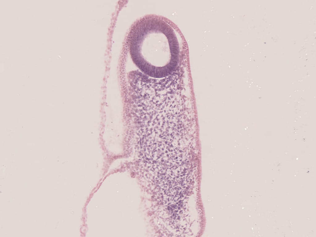 Chick, 33-Hour, Longitudinal Section, Hematoxylin and Eosin Stained Slides