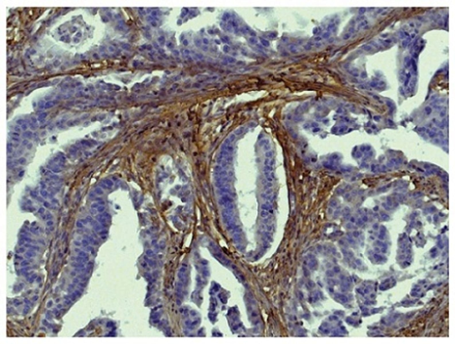 Anti-Collagen I Goat Polyclonal Antibody (Biotinylated) | VWR, part of ...