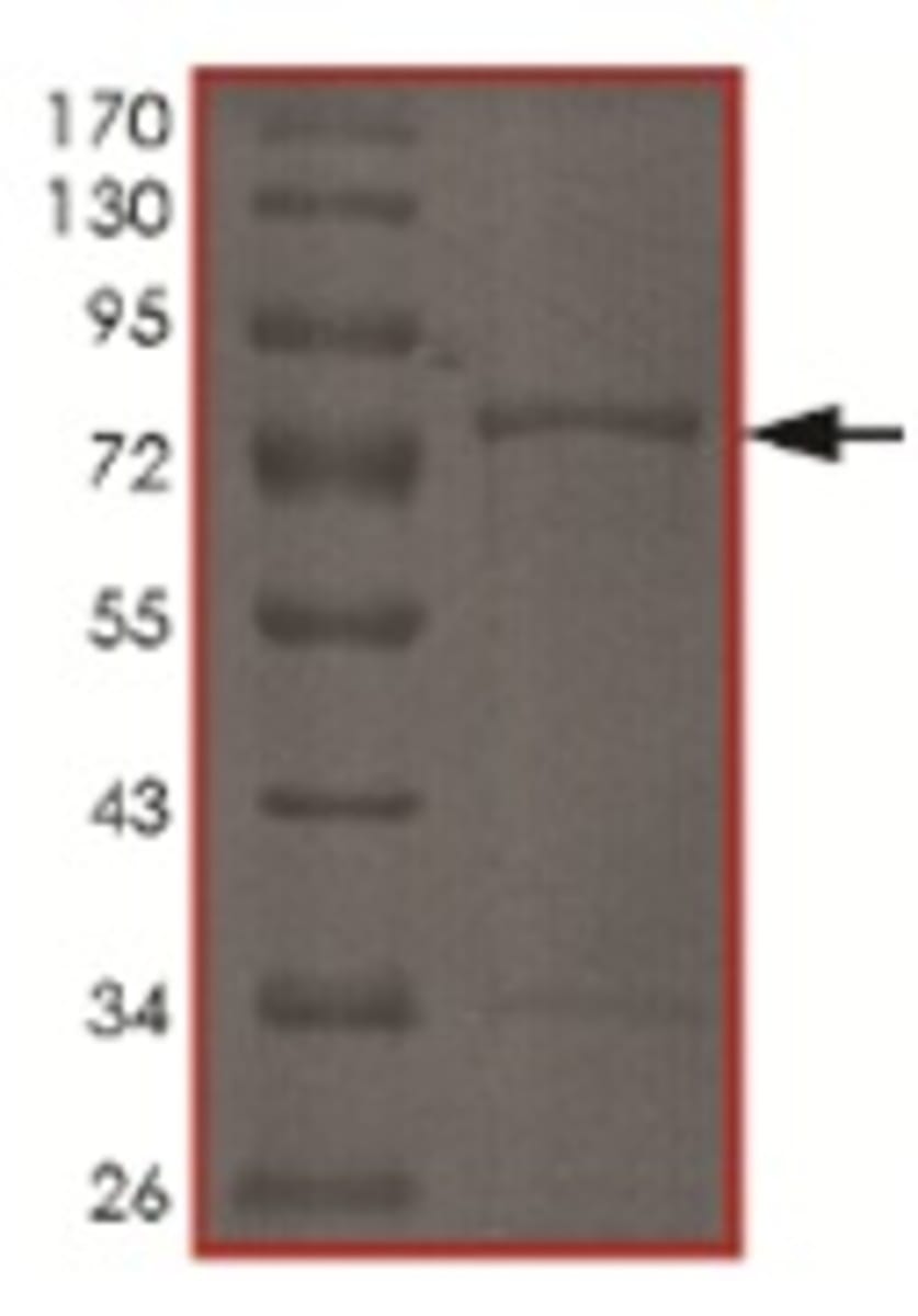 Human Recombinant CDKL2 (from Baculovirus (Sf9 Insect cells)) | VWR ...