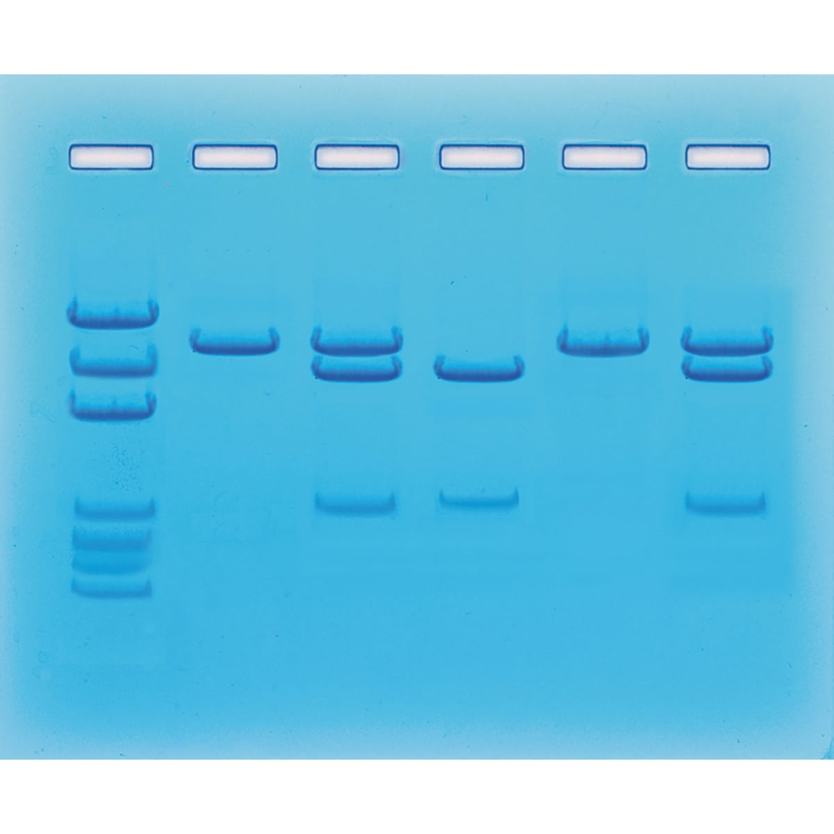Nucleic Acid Testing for COVID-19