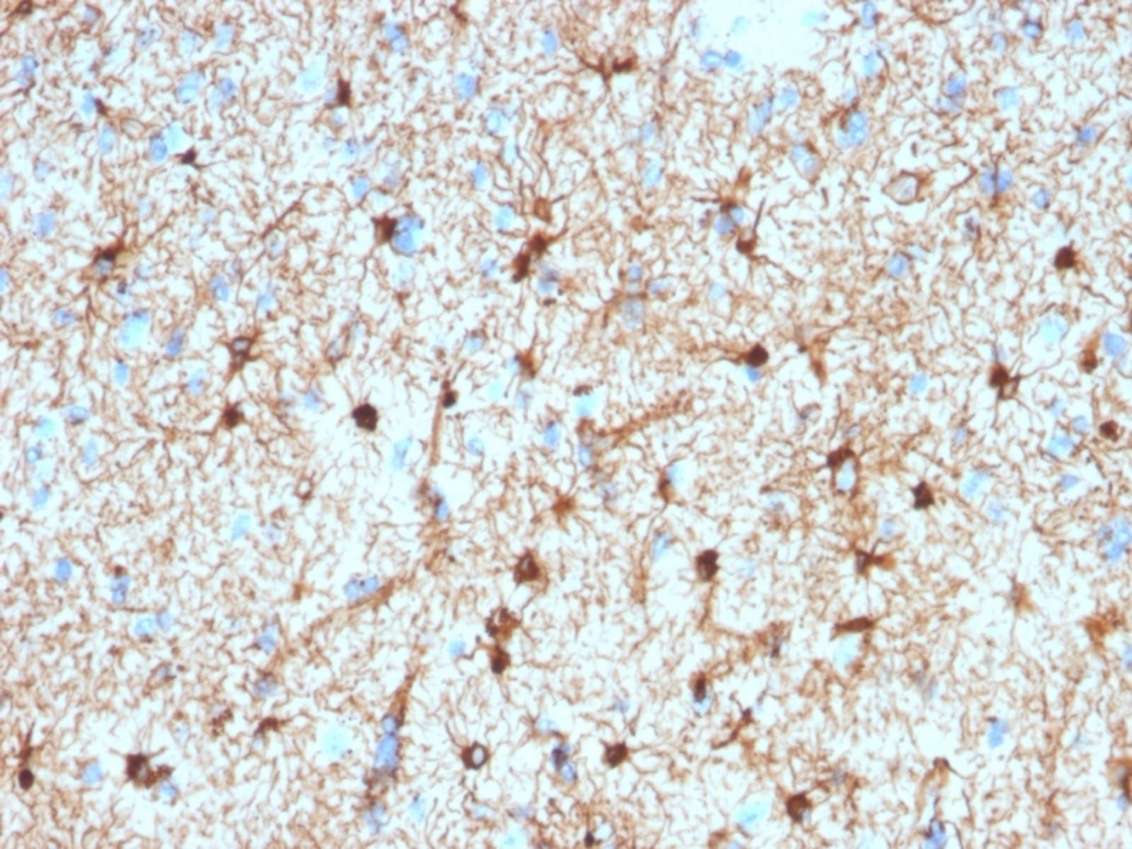 Anti-GFAP Mouse Monoclonal Antibody [clone: GFAP/2076] | VWR, part of ...