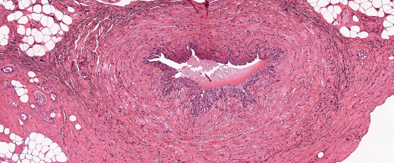 Vein, Mammal Slide