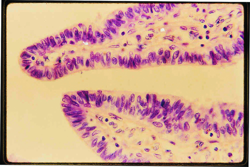 Oviduct, Isthmus Slide