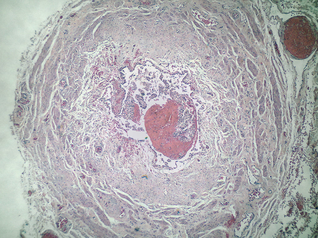 Ureter, Human Slide