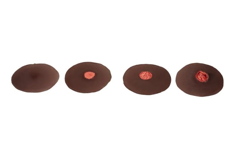 Medicor® Sticky Wounds