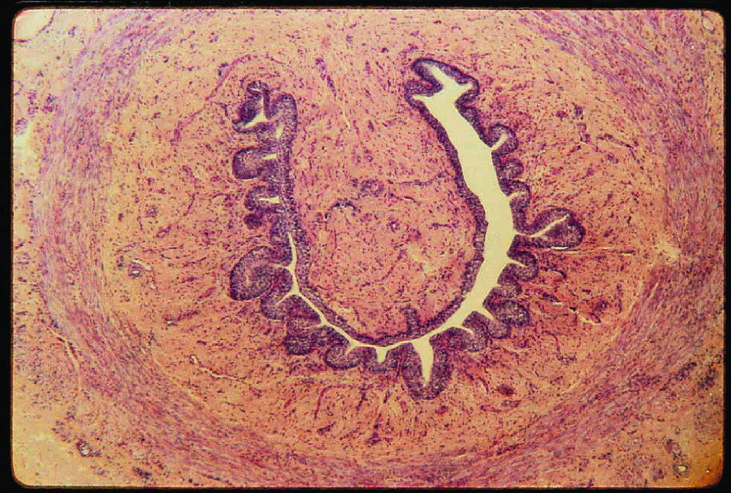 Urethra, Female Slide