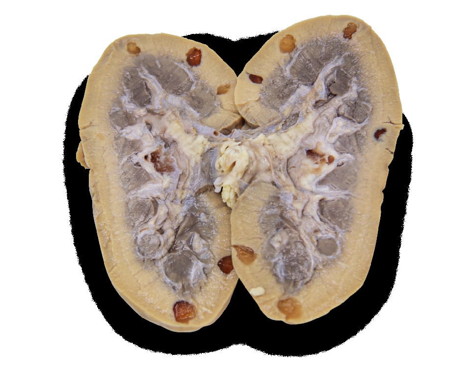 Ward's® Pure Preserved™ Pig Kidney with Polycystic Kidney Disease