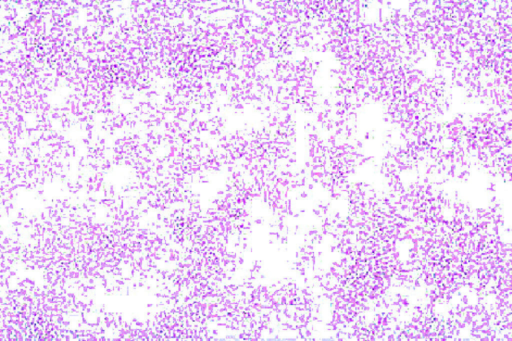 Vibrio cholerae Slide