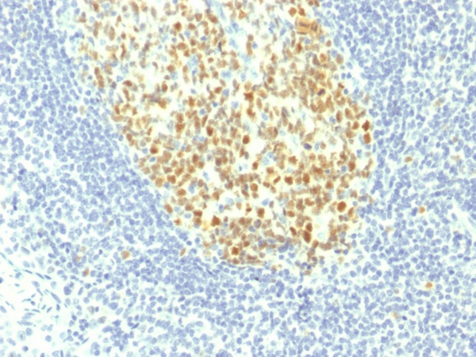 Anti-MCM7 Mouse Monoclonal Antibody [clone: MCM7/1467] | VWR, part of ...