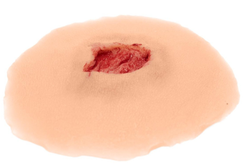 Medicor® Sticky Wounds