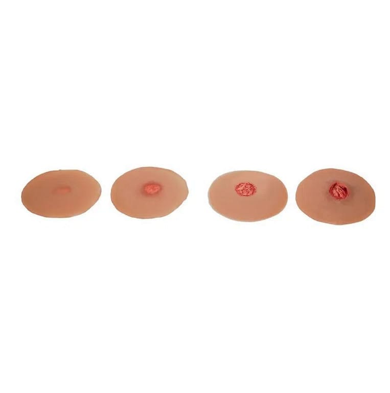 Medicor® Sticky Wounds