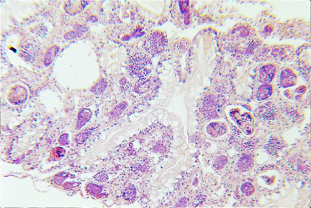 Schistosoma mansoni, Secondary Sporocysts, section, hematoxylin and triosin stained slides