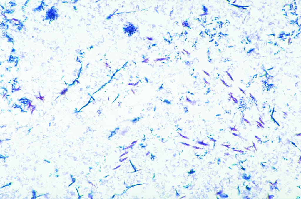 Corynebacterium diphtheriae Slide