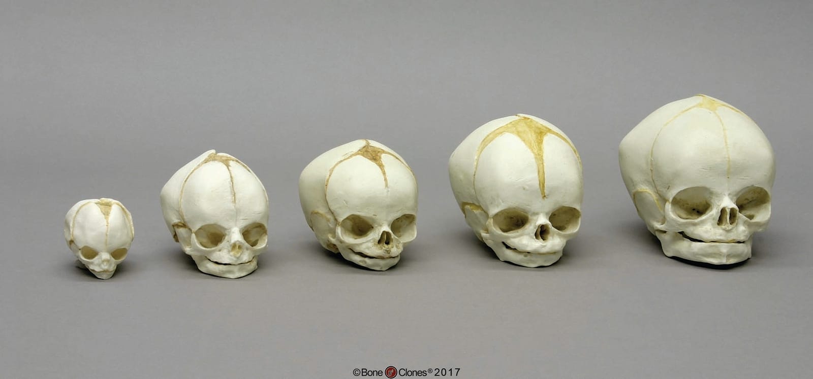 BoneClones® Fetal Skull Set