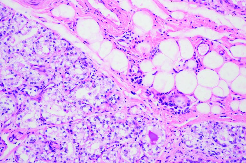 Mammary Gland, Active Slide