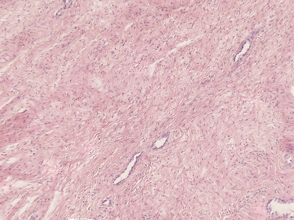 Smooth Muscle Slide
