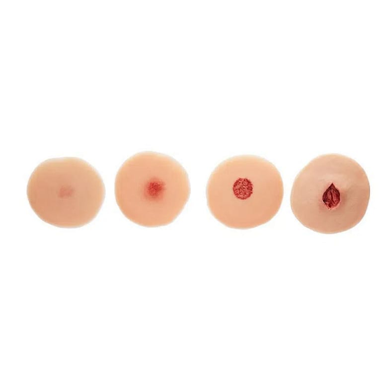 Medicor® Sticky Wounds