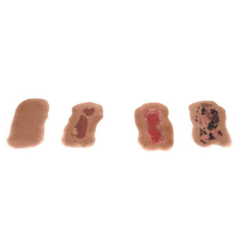 Medicor® Sticky Wounds
