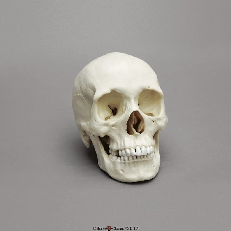 BoneClones® Regional Human Skulls