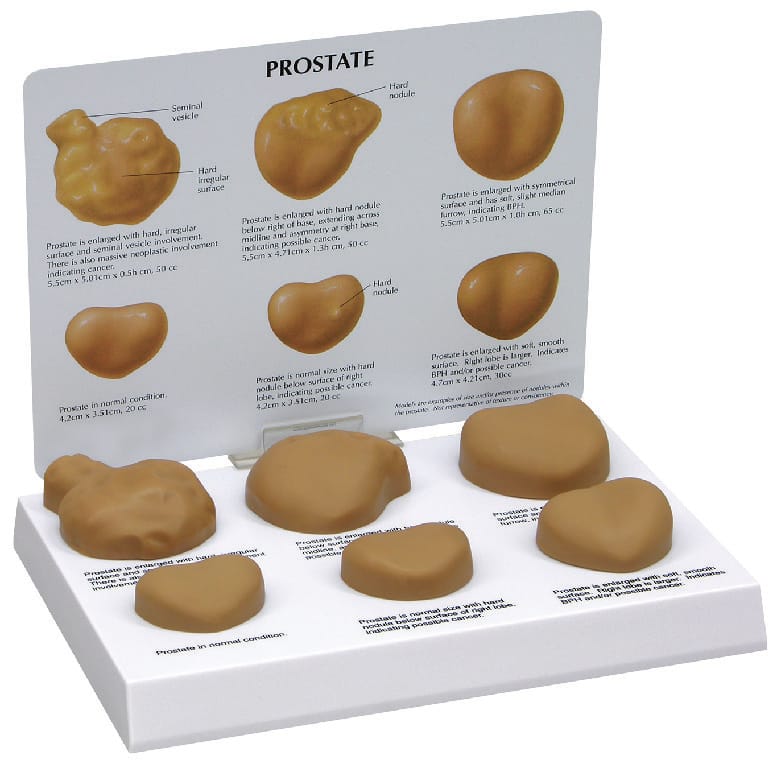 GPI Anatomicals® Prostate Disease Model
