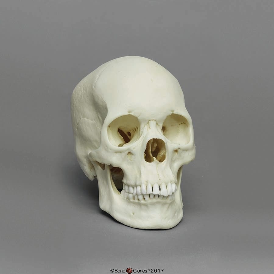 BoneClones® Regional Human Skulls