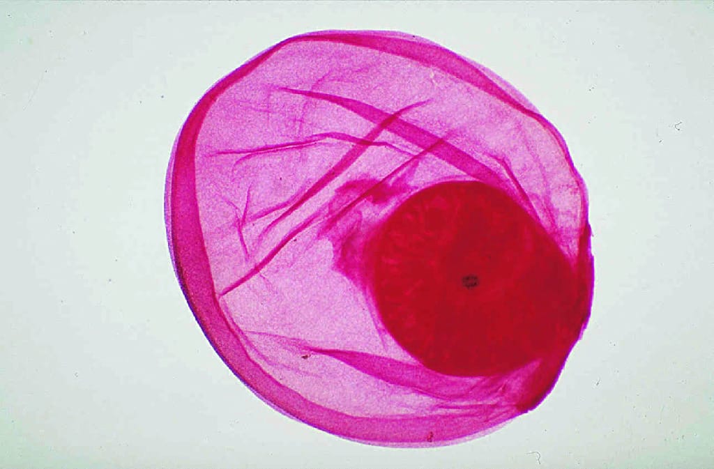 Taenia solium, Cysticercus Slide
