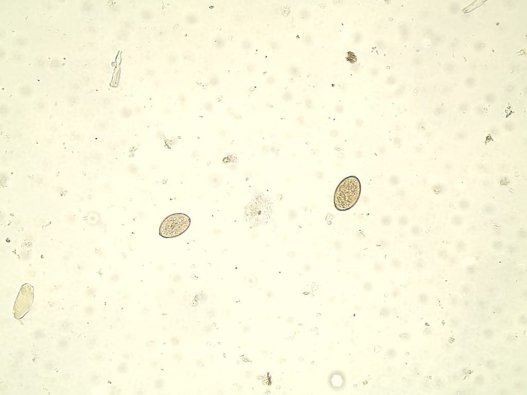 Diphyllobothrium latum, Eggs Slide