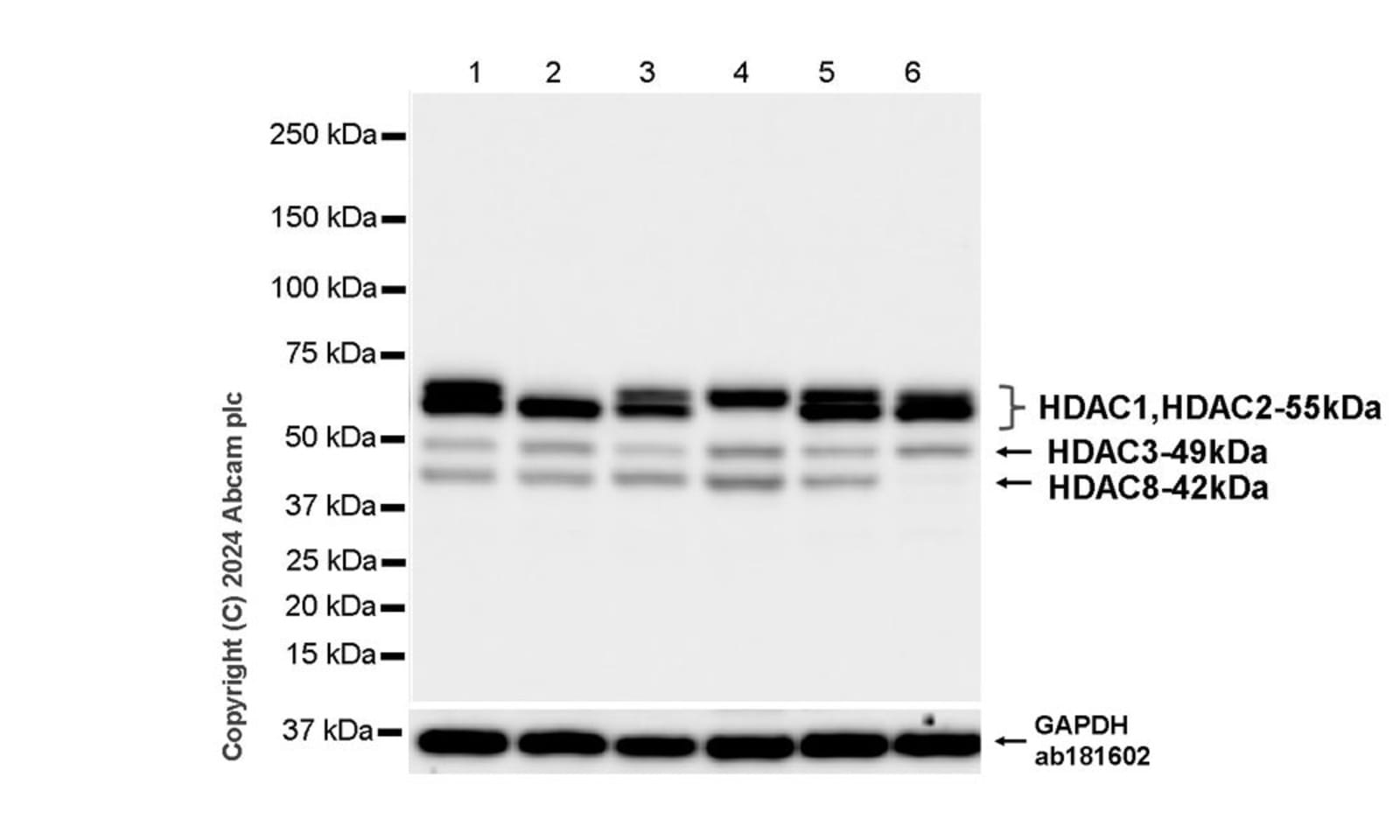 Anti-HDAC1+HDAC2+HDAC3+HDAC8 Rabbit Recombinant Multiclonal Antibody ...
