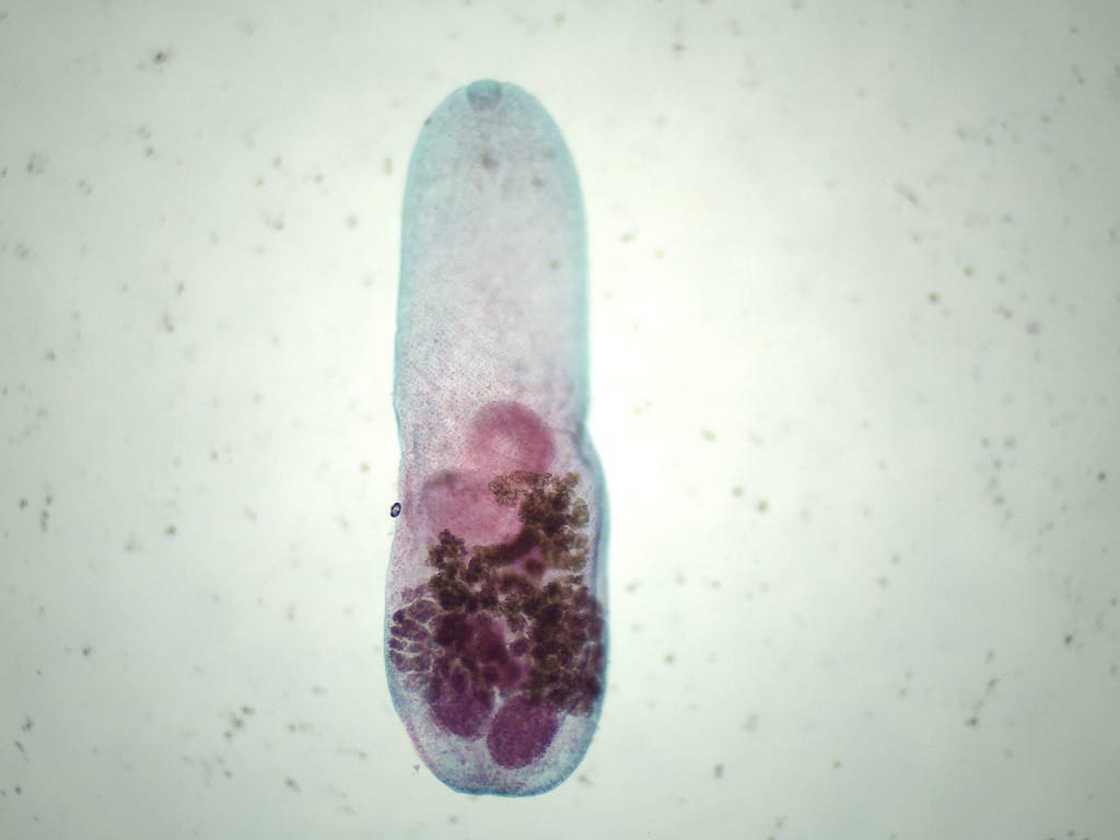 Heterophyes heterophyes Slide
