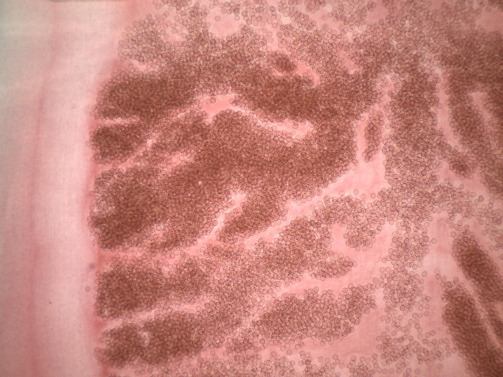 <i>Taenia pisiformis</i>, Mature/Gravid Proglottids Slide