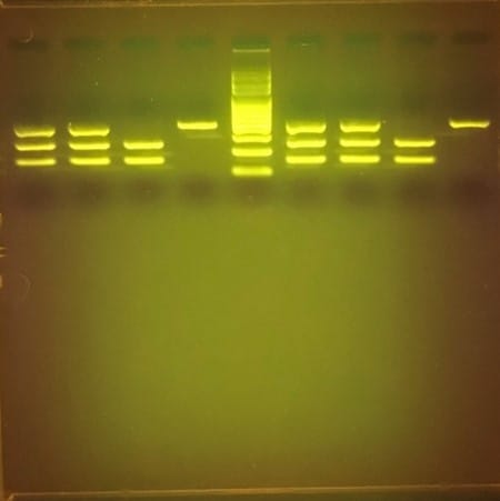 miniPCR® Sickle Cell Genetics Lab: Diagnosing Baby Marie™