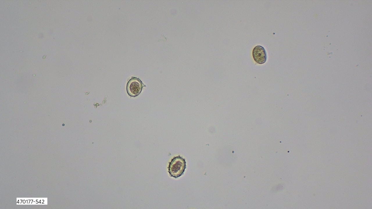 <i>Ascaris lumbricoides</i> Slide