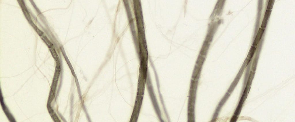 Medullated Nerve Fibers, Teased Preparation Slide