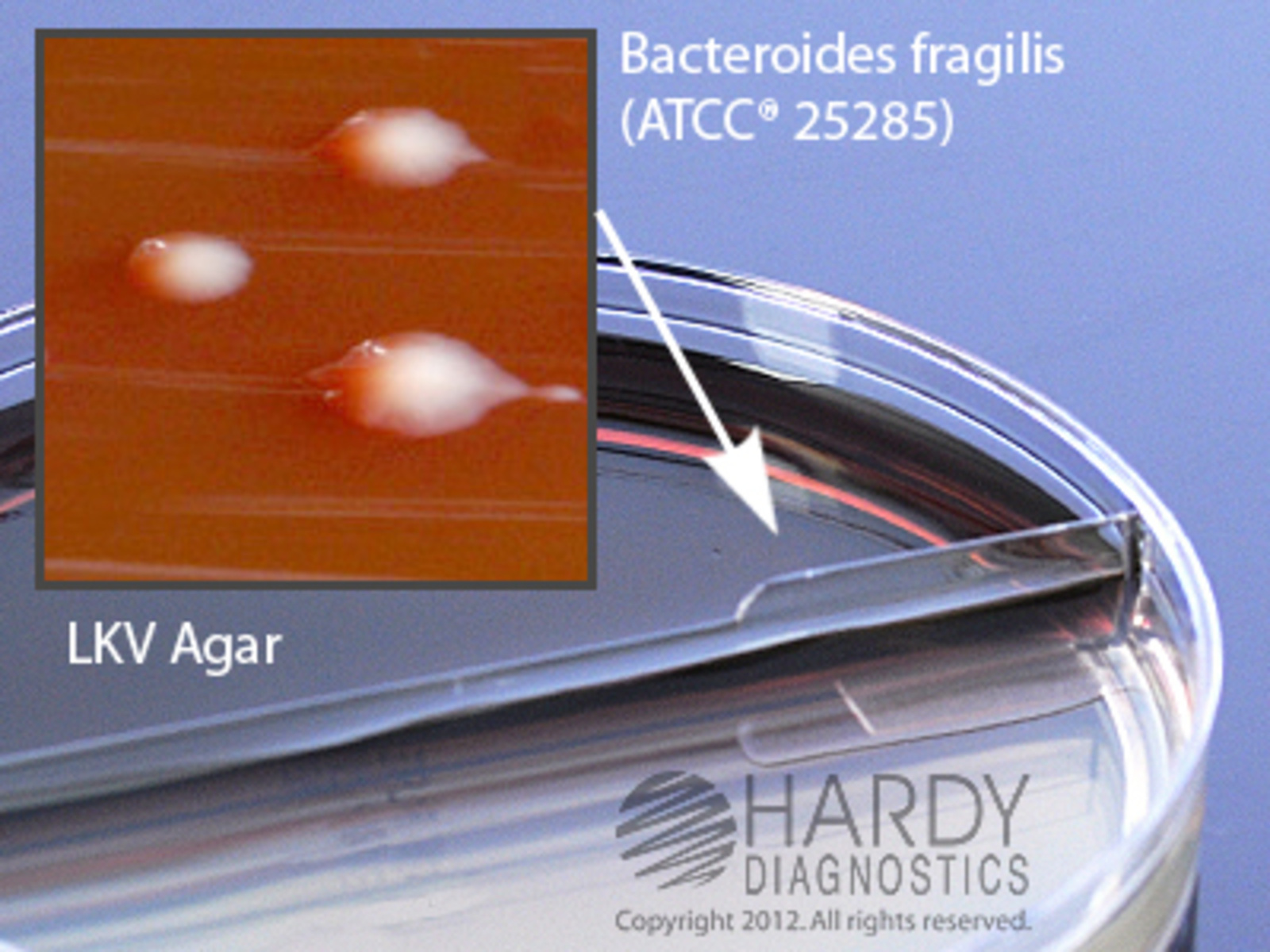 BBE/LKV (Bacteroides Bile Esculin/Laked Blood Kanamycin Vancomycin ...