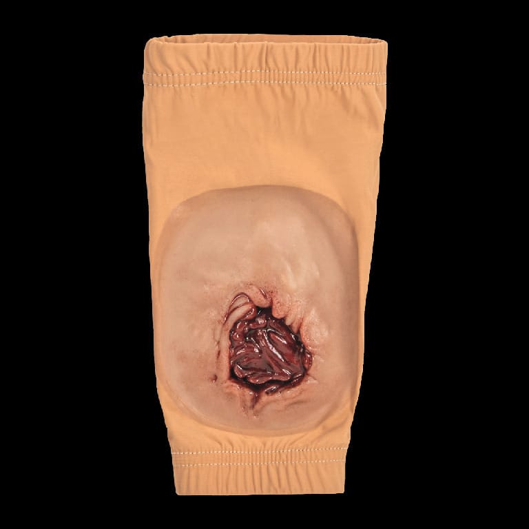 STOPS® Wound Clothing