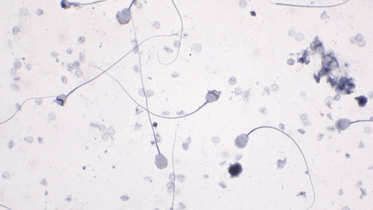 Sperm, Guinea Pig Slide