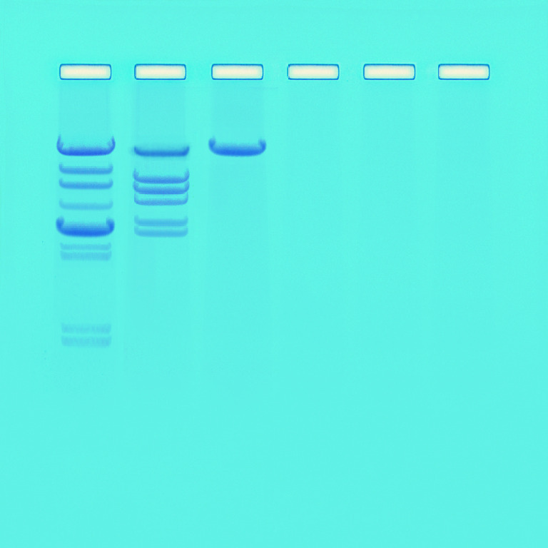 Analysis Of Restriction Enzyme Clevage Patterns Of DNA Lab Activity Kit