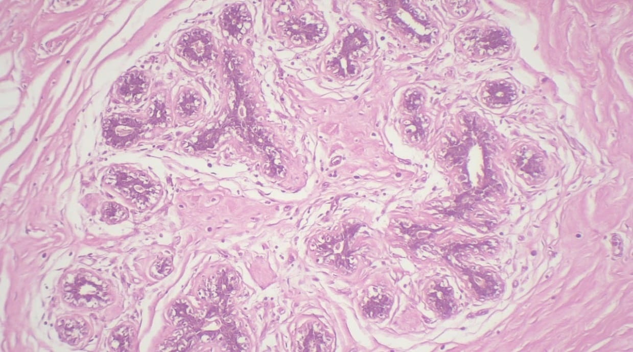 Mammary Gland, Inactive, Human Slide